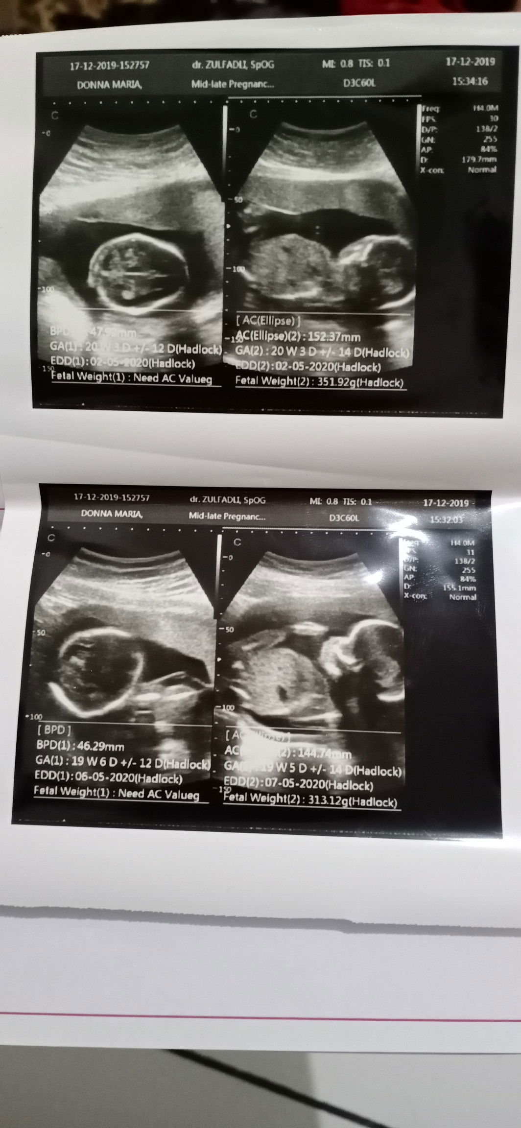 HPL maju terus setiap bulan ?