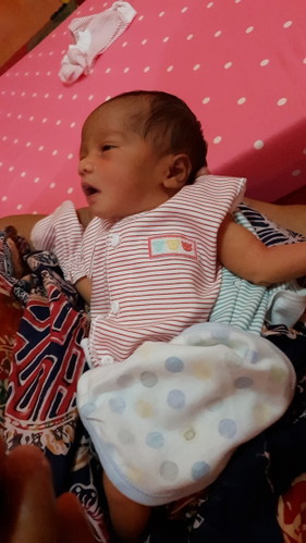bayi lahir BBlr