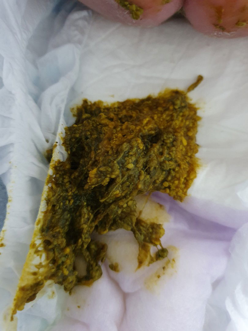 Najis Baby - susu similac rumusan khas.