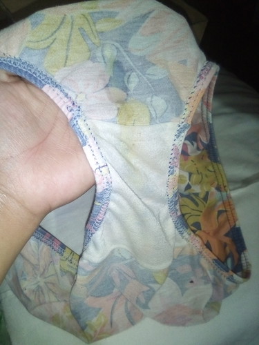 White discharge is it normal for 33wks and 6days pregnant?