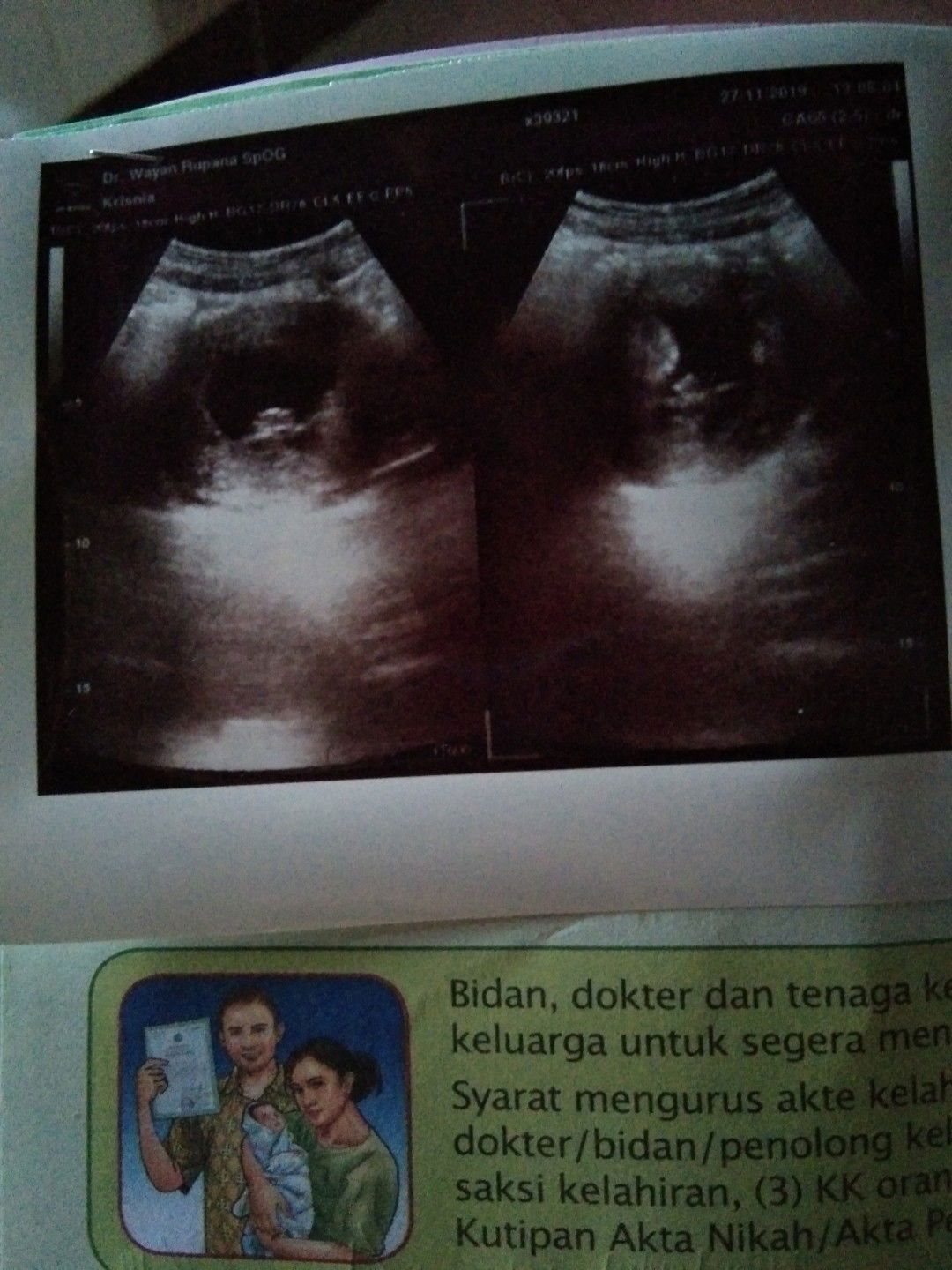 apa yang harus dilakukan