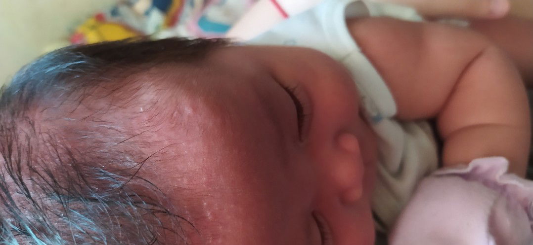 Baby Rash or Nah?