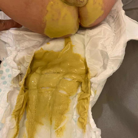4 months old poop