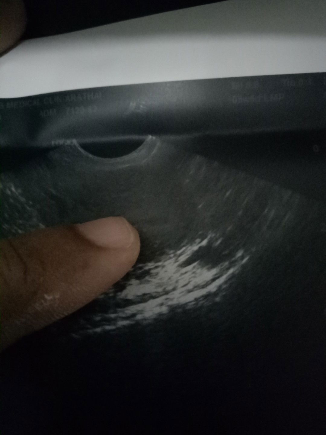 ทำไมยังไม่เห็นเลยท้องจะสองเดื่อนแล้ว