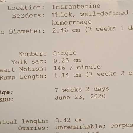 How to know your baby's gender as early as now?