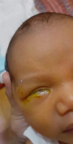 SORE EYES POBA SIYA?