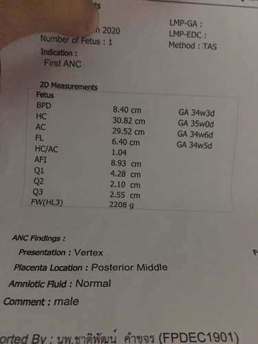 ไปหาหมอตอน 34 weeks 5day น้ำหนักลูก 2208 น้อยไปไหมคะ ช่วยบอกที ท้องแรกไม่ค่อยรู้เรื่อง?? กลัวคลอดออกมาลูกตัวเล็ก กังวลมากคะ