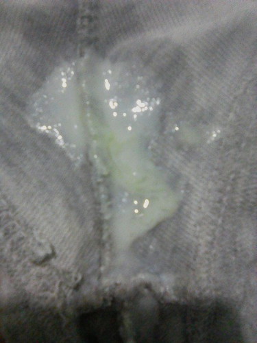Mucus Plug Na Ba