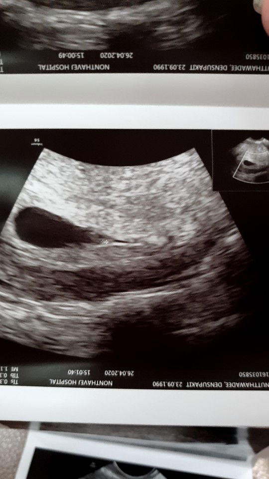 Cherry Nutthawadee profile icon