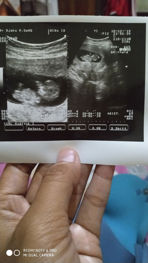 Alkhamdulillah dedek sehat ??