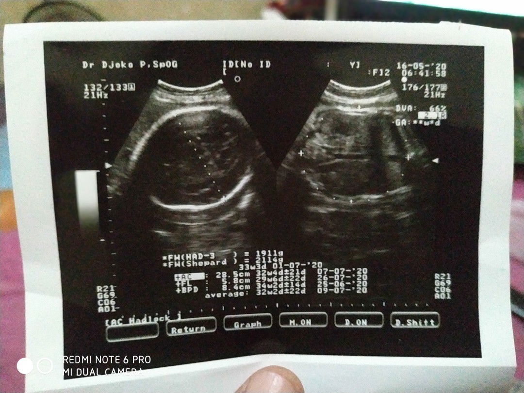 11 th pernikahan di hadiahi debay cowok