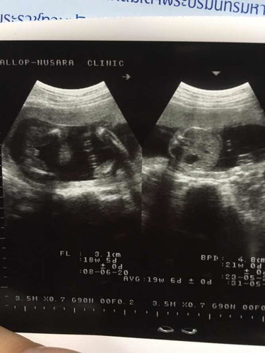 ช่วยดูเพศลูก