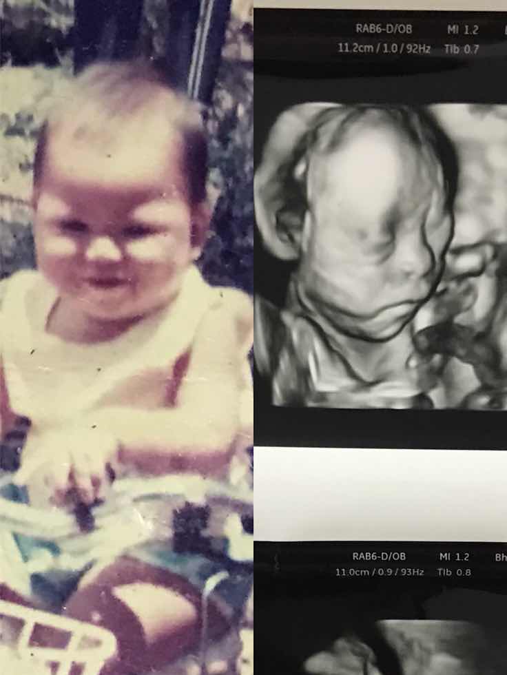 สวัสดีครับแม่ๆ ตอนนี้ผมอายุ 33 week แล้วครับ ผมยังไม่มีชื่อเลยครับเพราะพ่อกับแม่ยังตกลงกันไม่ได้ ผมขอเสียง แม่ทีมลูกชาย แม่ทีมกำหนดคลอด 31 ธ.ค. หน่อยคร้าบ ???? แม่ๆว่า ผมหน้าตาเหมือนแม่ไหมครับ