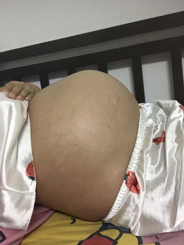 33 week แล้วค่ะ