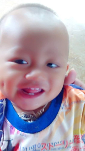 มีความกังวลเรื่องนี้มากคะ