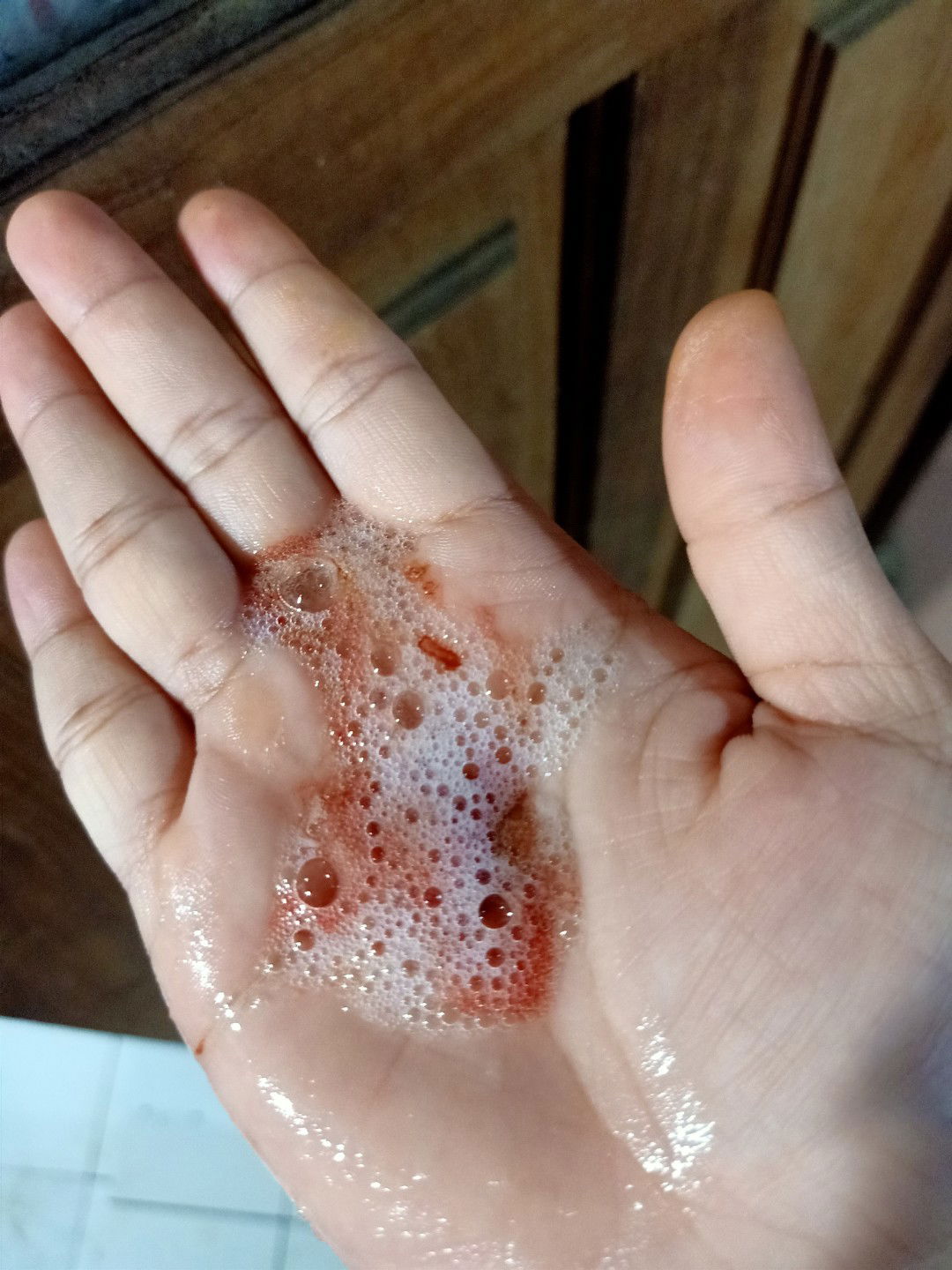 muntah berdarah habis makan salak