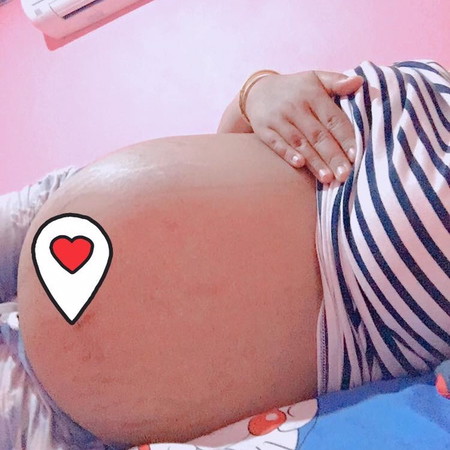 มีวิธีไหนช่วยเร่งให้คลอดเร็วไหมคะ