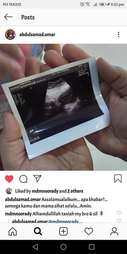 Baru Nampak Kantung 9w 1day