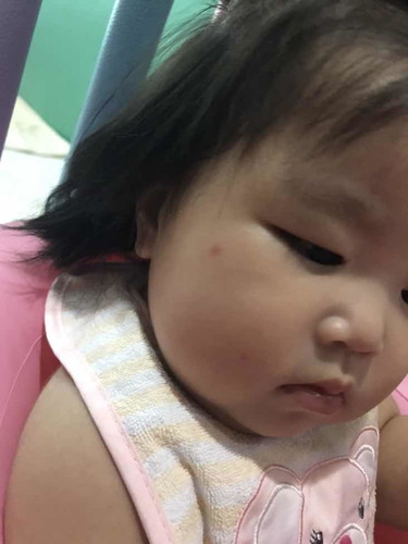 ไม่แน่ใจว่าลูกโดนอะไรกัด