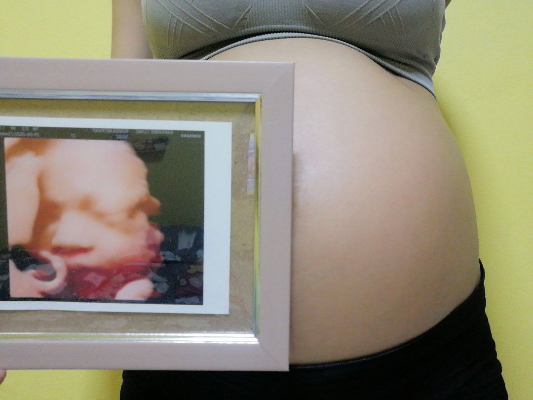 Suni Netpanit profile icon