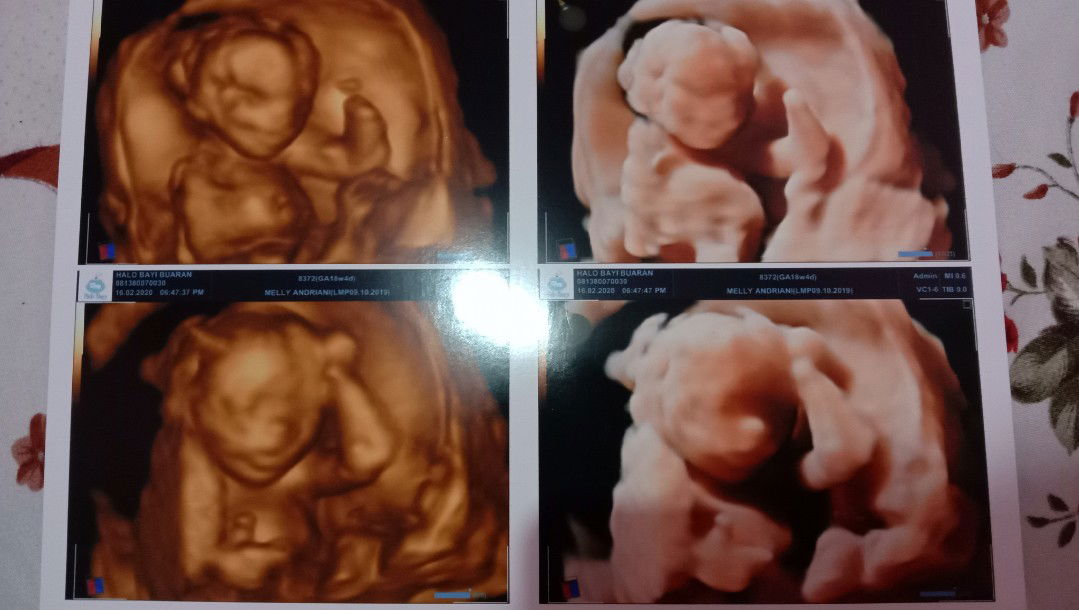 Melly Adriannii profile icon