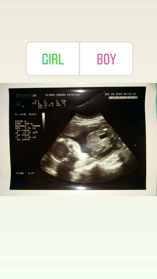 Ines Savitrie profile icon