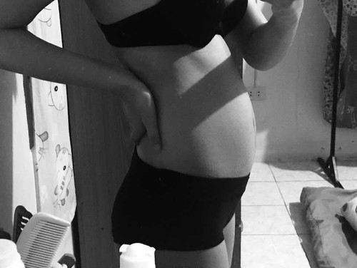 มีแม่ๆคนไหนเป็นไหมค่ะ?