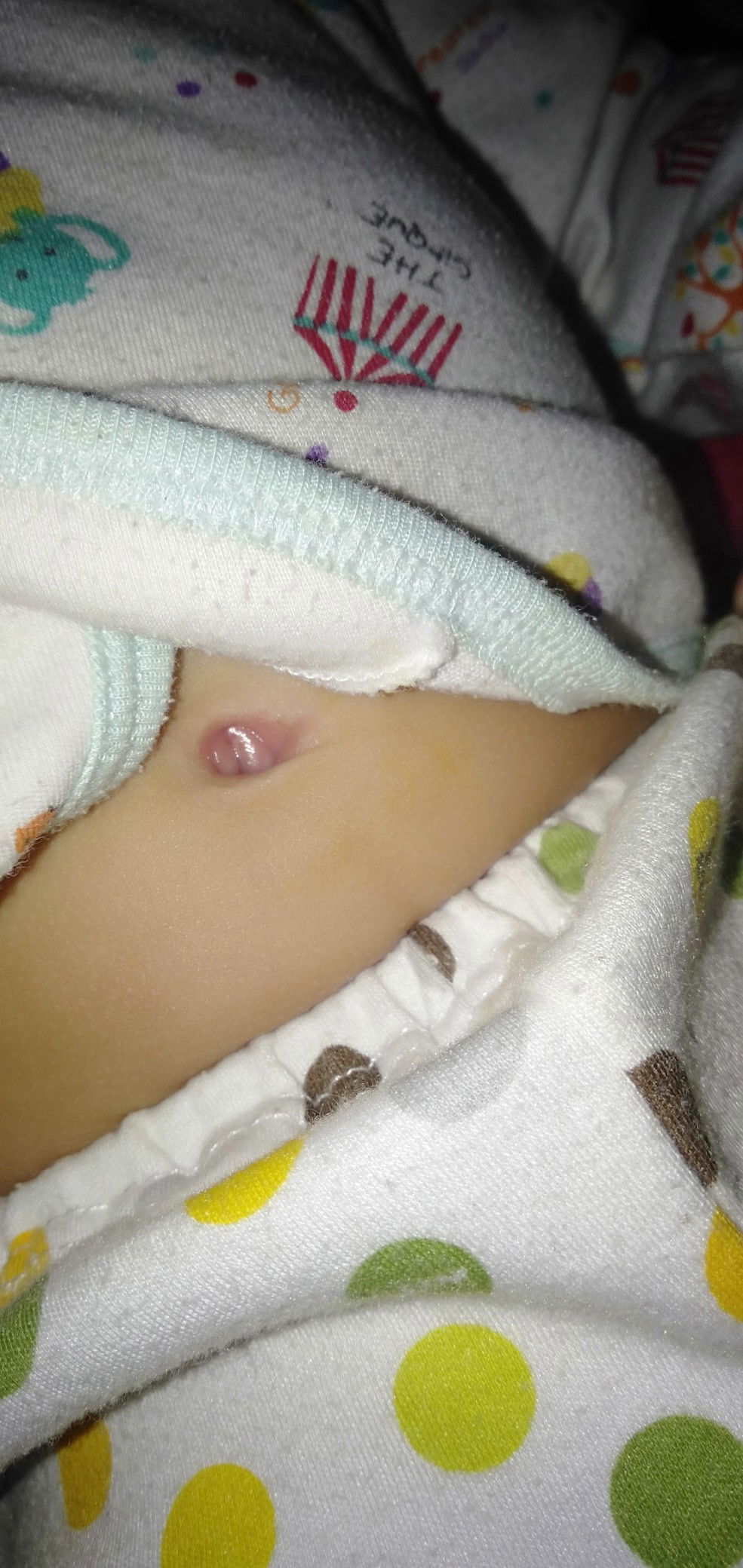 keluar cairan dari dalam pusar