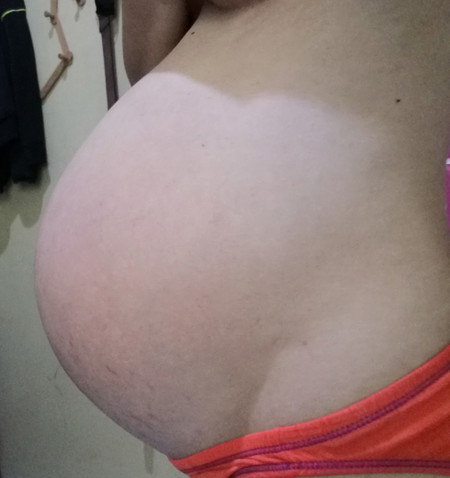 37w6d.