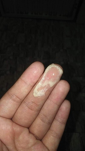 มันคืออะไร