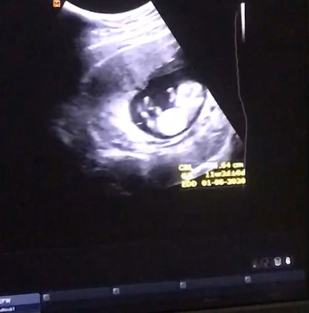 อยากทราบเพศลูก
