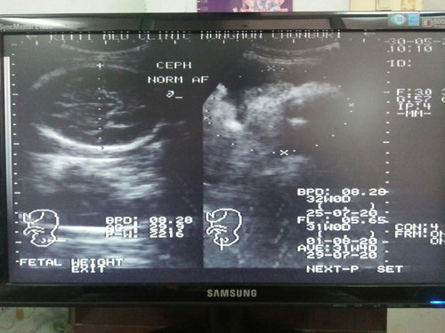 น้องตัวโต