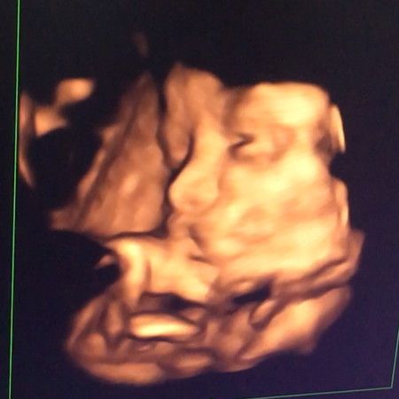32 week.