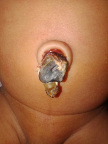 ขอคำแนะนำ