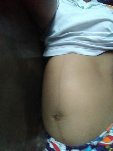 อาการปวดไตรมาส3