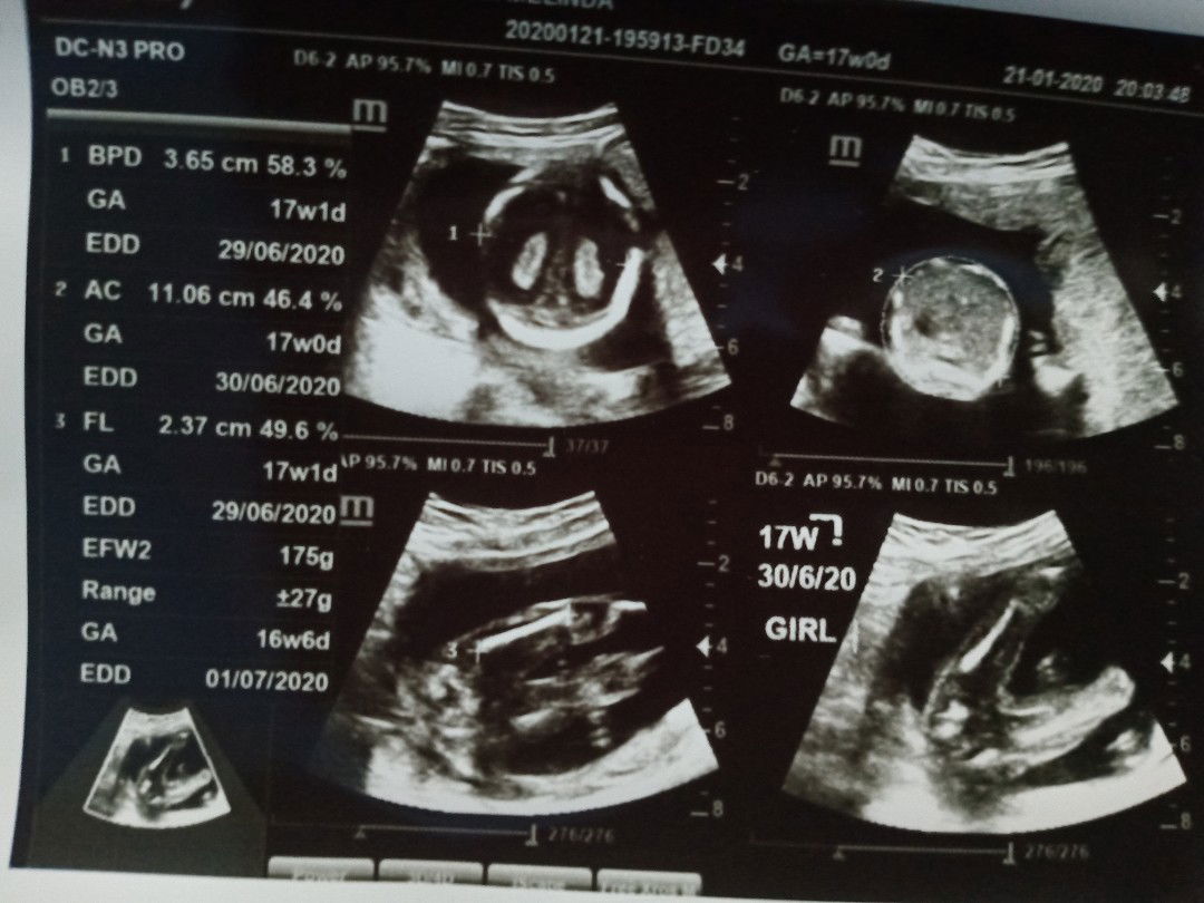 17 week d kasih tau JK