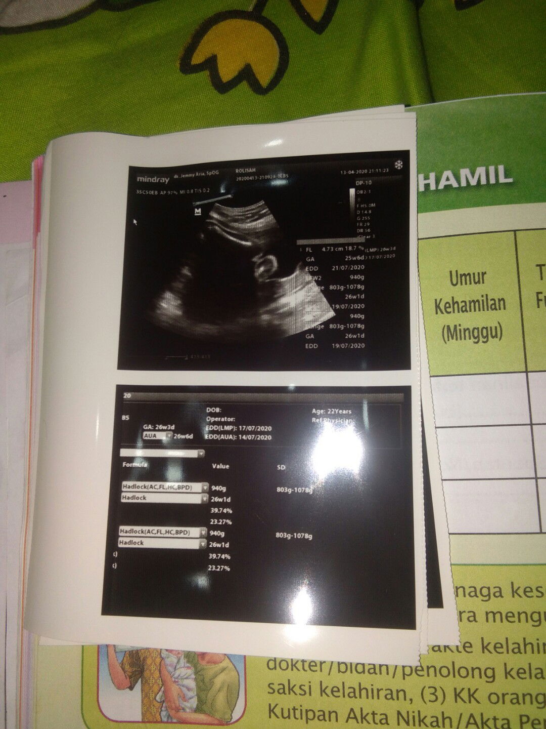 adakah yang kandunganya sma dengan aku 26 minggu 4 hari