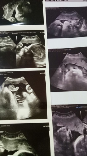 เรื่องจริงที่ไม่อยากให้เกิดกับใครเลย