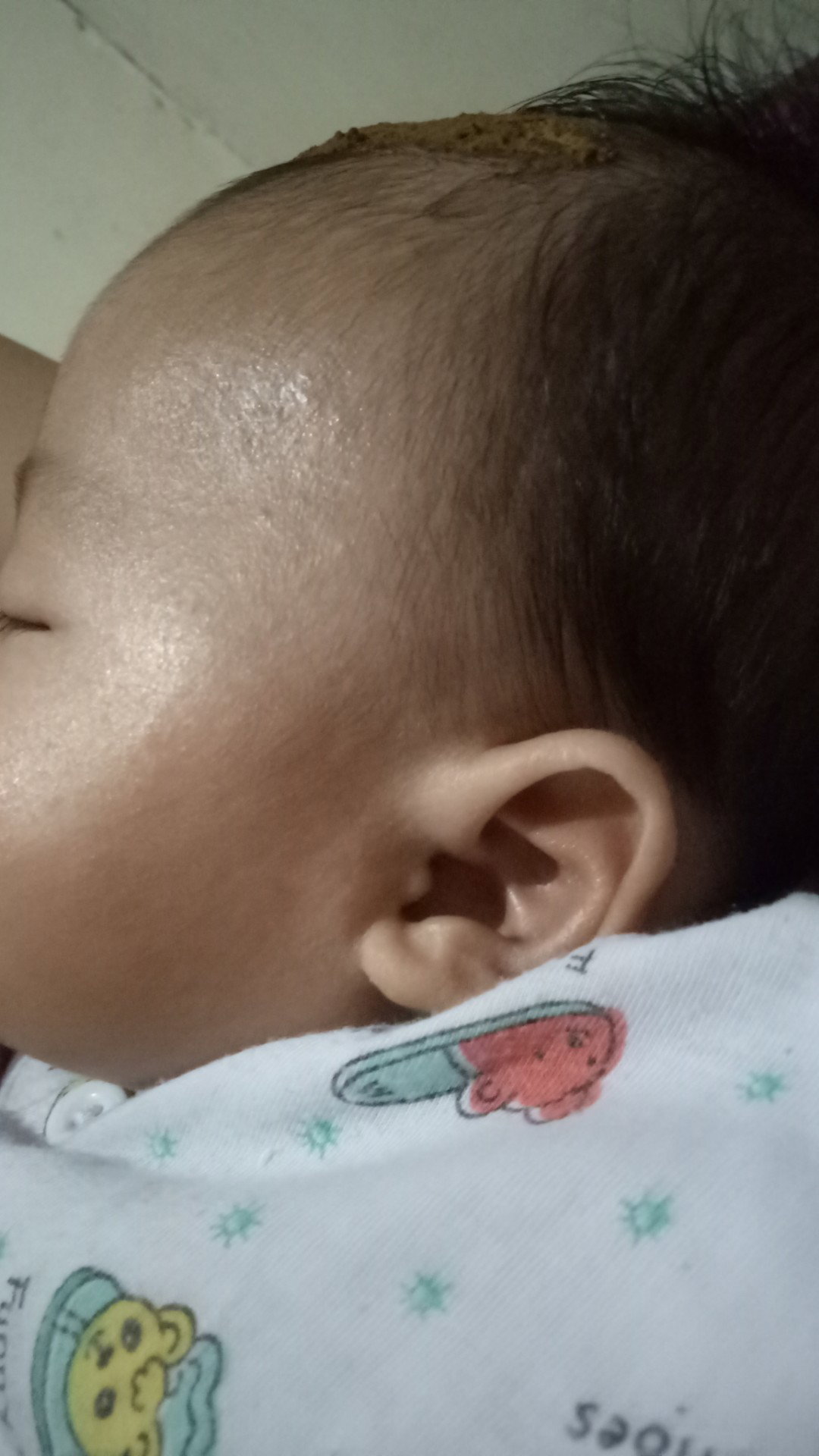 pipi atas kasar