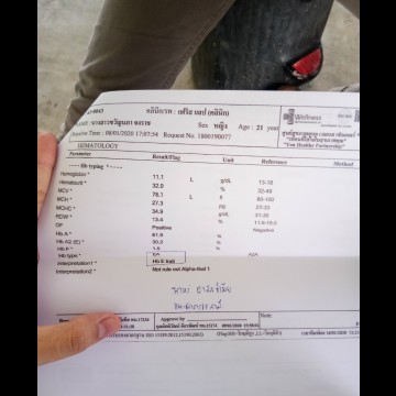 16w5d