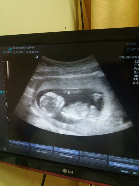 calon ibu profile icon