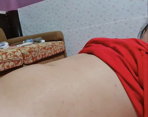 11w5d ท้องใหญ่ไปไหมคะ