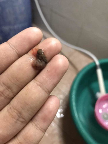 สงสัย