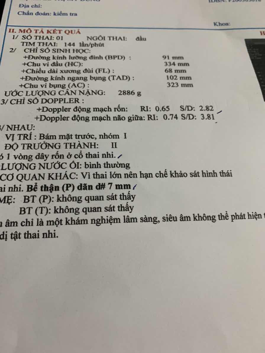 Cần tư vấn ạ