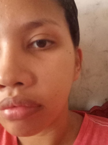 Pamamaga ng ngipin