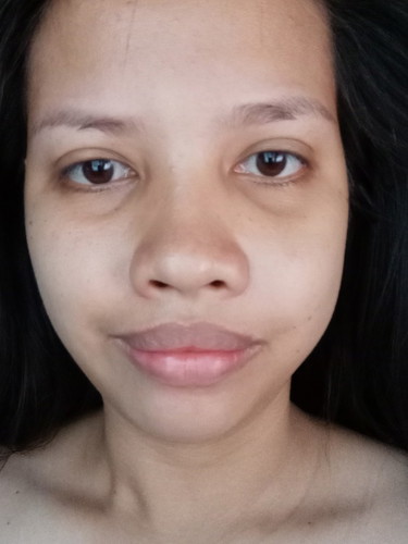 Pagbunot ng ngipin