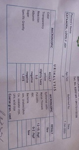 urinalysis