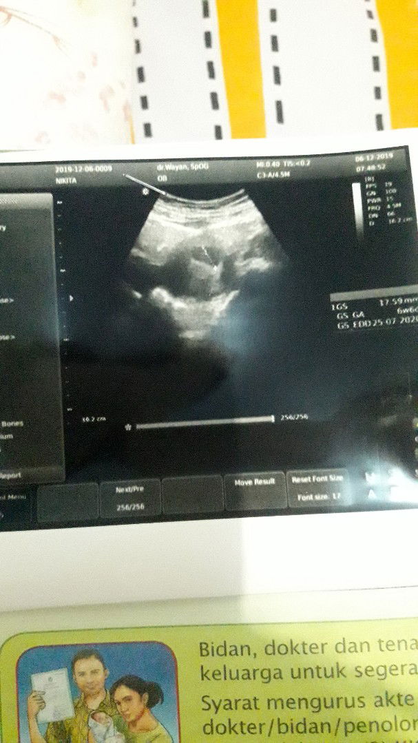 seputar kehamilan