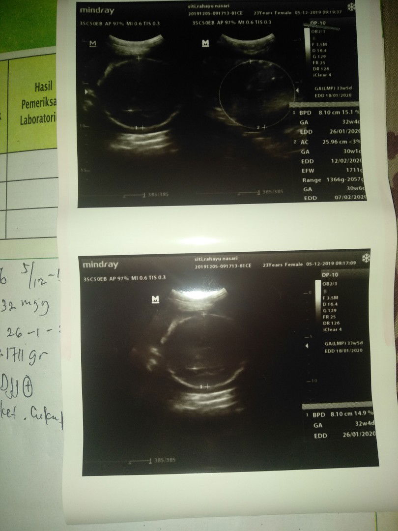 bayi gak kelihatan jenis kelamin nya saat udh???