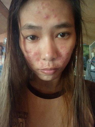 สภาพหน้าวันนี้